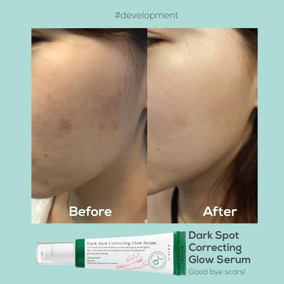 Axis-Y Dark Spot Correcting Glow Serum