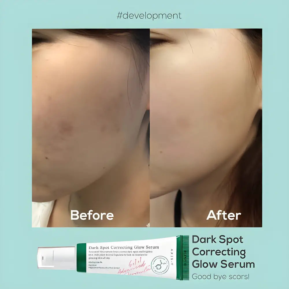 Axis-Y Dark Spot Correcting Glow Serum - face serum